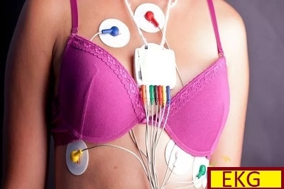 24H Holter EKG-a - Popusti