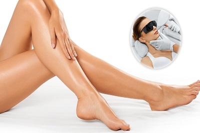 Kozmetički salon Happy Lady: Laserska epilacija celog tela , Laserska epilacija - brazilka